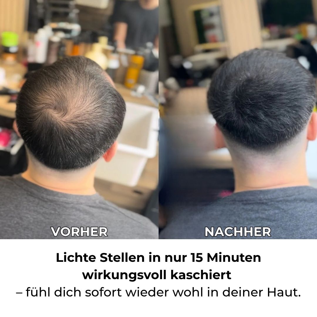 OGIZ Hairconcealer - Für sichtbar volleres Haar – in Minuten