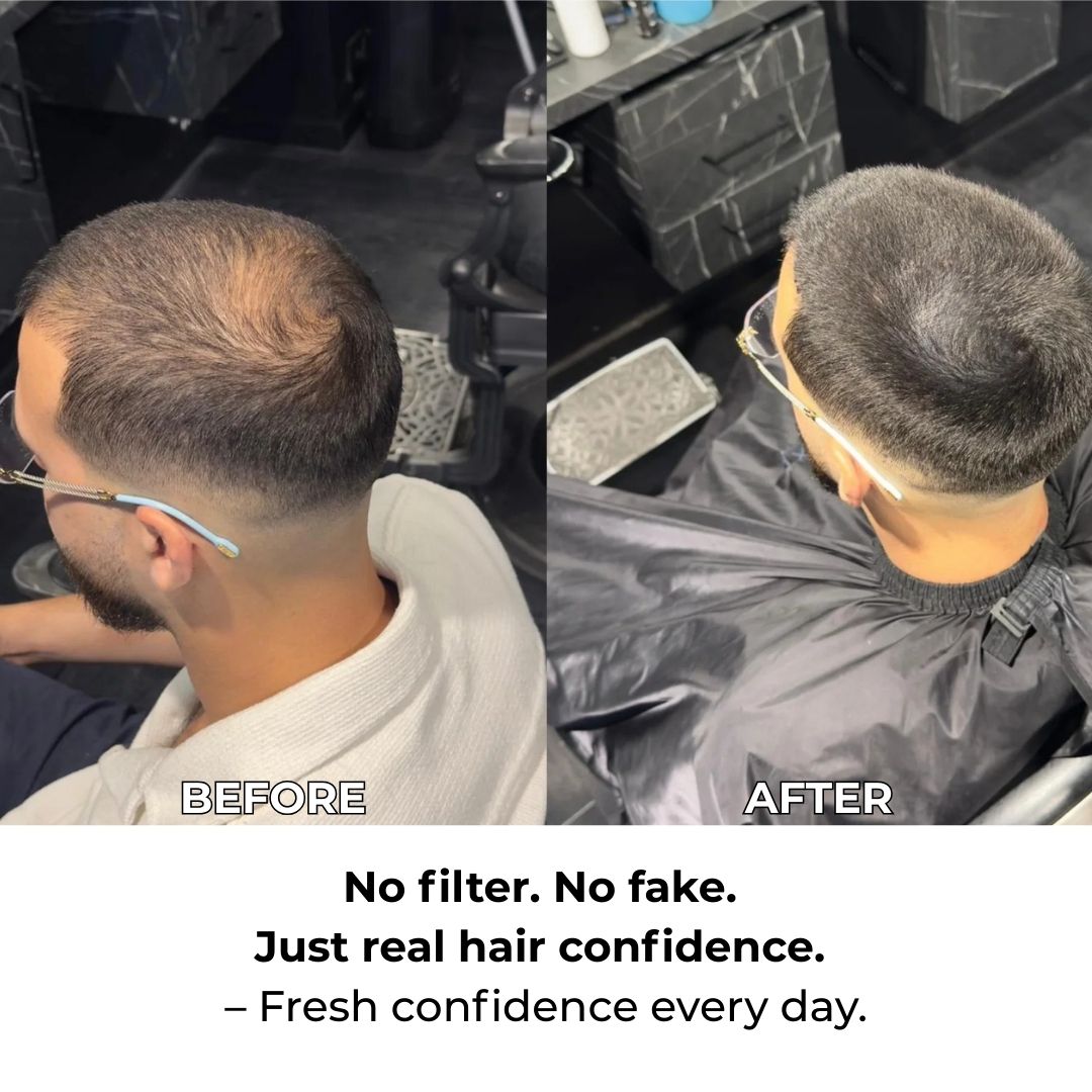 OGIZ Hairconcealer - For Visibly Fuller Hair – in Minutes