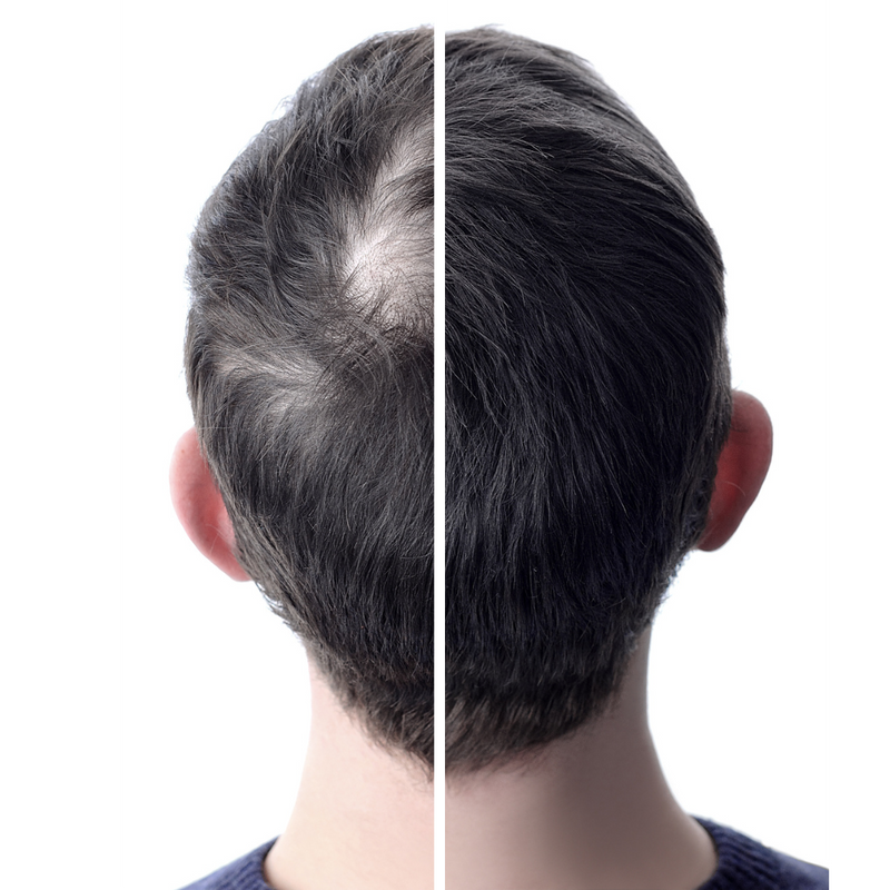 6 Gründe, warum du voluminhair lieben wirst